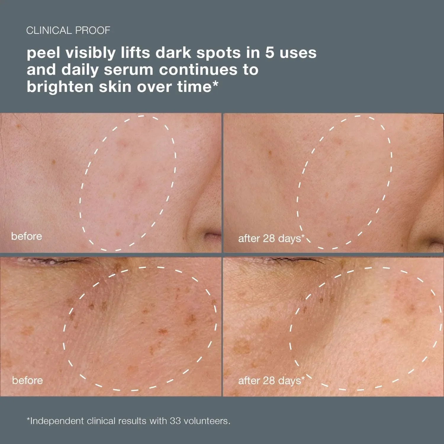 Dermalogica | Powerbright Dark Spot System